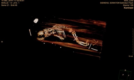 Scans revealed the remains of a baby tucked under the feet of Swedish bishop Peder Winstrup.