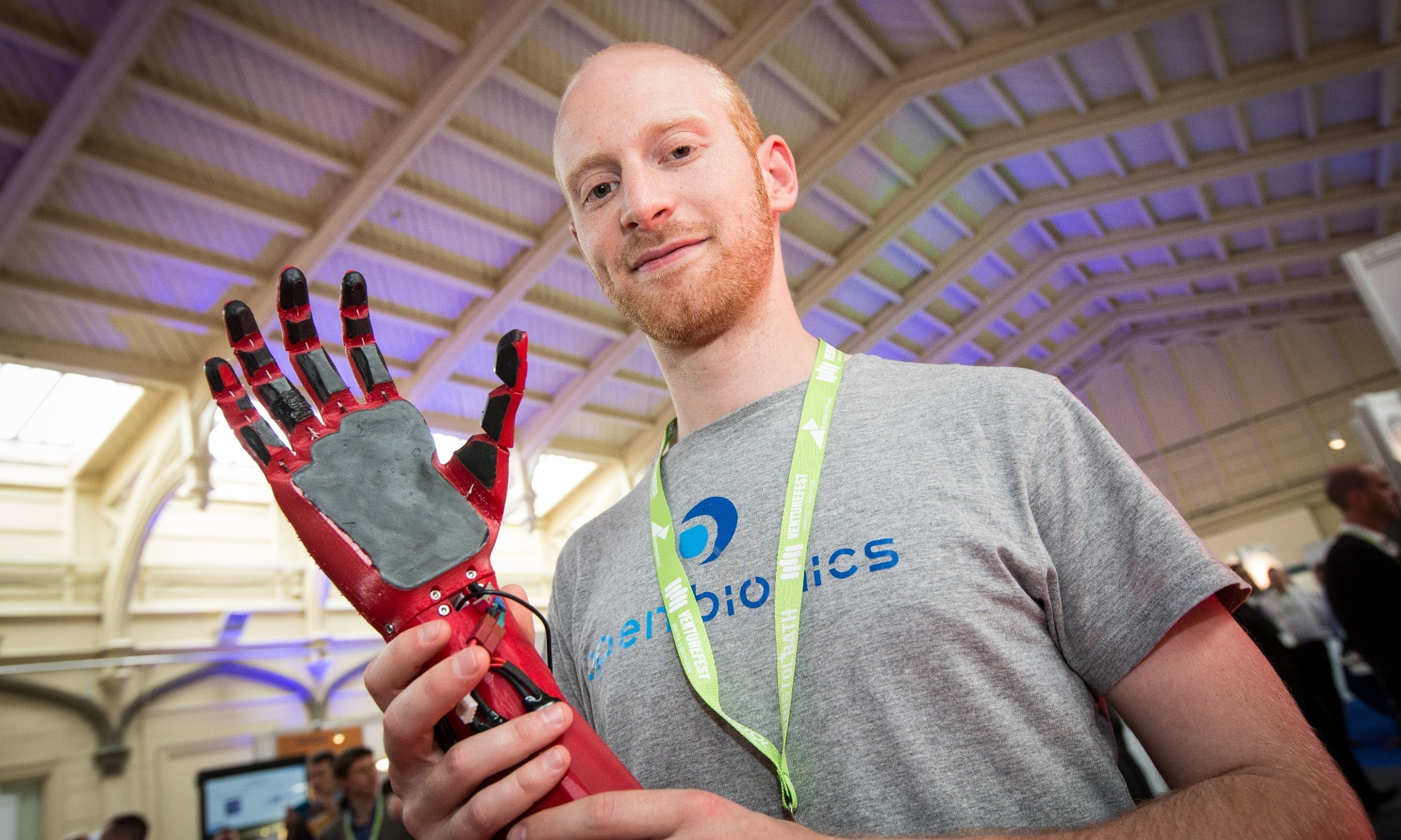 Open Bionics протезы