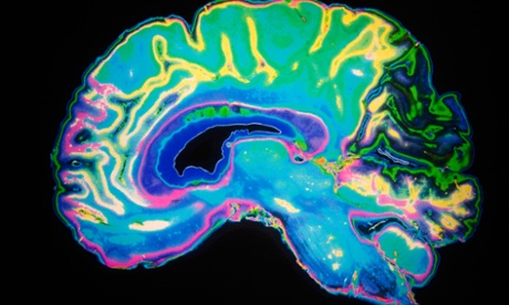 Artificially Coloured MRI Scan Of Human Brain