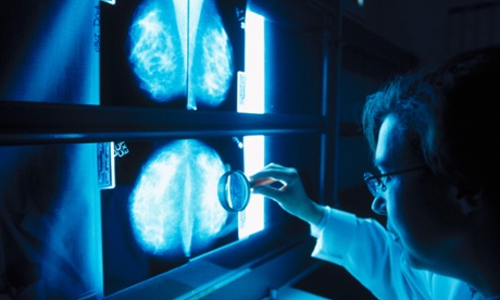  Doctor looking at mammograms.