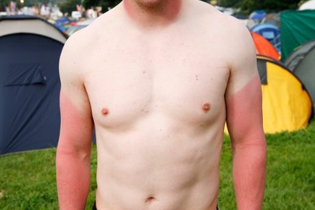 Glatonbury suntan.