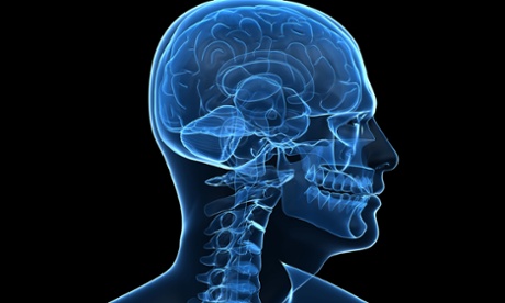 image of a brain scan.