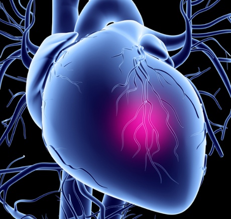 Heart attack, conceptual computer artwork