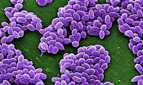 Spores from the Sterne strain of anthrax