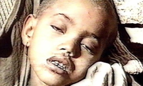 Footage of Birhan Woldu during the famine