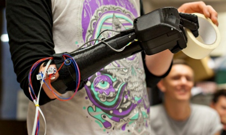 Startup Open Bionics 3D-printed bionic hand