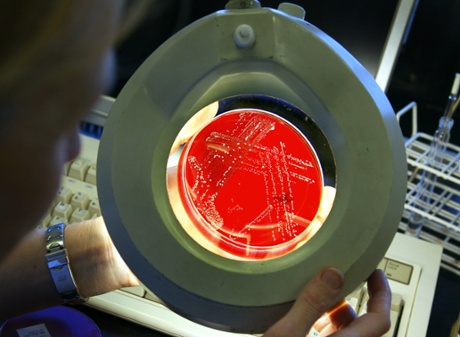 Antibiotic-resistant superbug related to the golden staphylococcus virus.