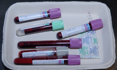 Researchers say early detection of HIV and treatment can in some cases limit infection.