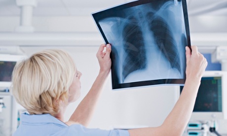 Nurse looking at x-ray in radiography dept