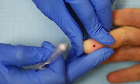 An HIV test in progress