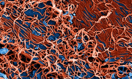An image provided by the National Institute of Allergy and Infectious Diseases shows a a scanning electron micrograph of Ebola virus particles (red).