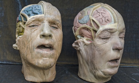 Two plaster medical heads. image supplied by phoebe@reesandco.com