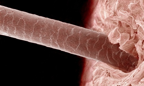 Magnified human strand of hair