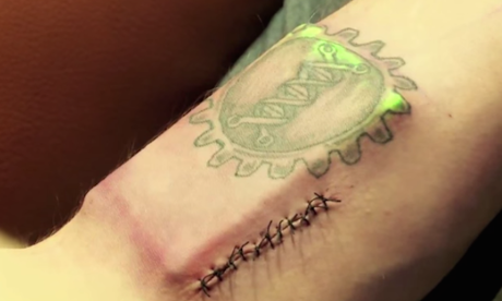 DIY cyborg … Tim Cannon's Circadia implant monitored his body temperature