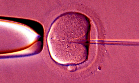 artificial insemination of human female egg