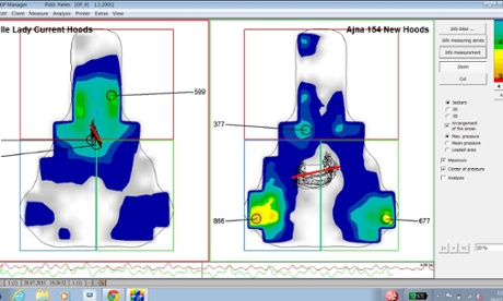 The pressure map of Helen Pidd’s old Selle Italia Diva Flow saddle (left) and new Bontrager Ajna saddle (right). Green and yellow spots show where the pressure is greatest. Pressure should be concentrated underneath a cyclist’s sit bones rather than towards the nose of the saddle, where soft tissue can suffer permanent damage.