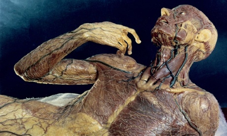 A wax model showing the superficial lymph vessels of the human body, on display in the Museo La Specola, Florence.