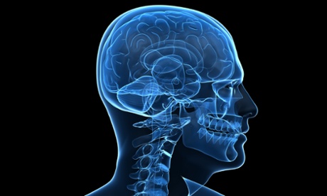 x ray scan human brain.
