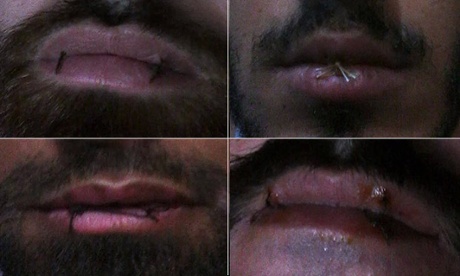 Four Manus Island asylum seekers have sewn their lips