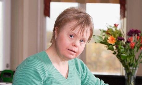 woman with down's syndrome