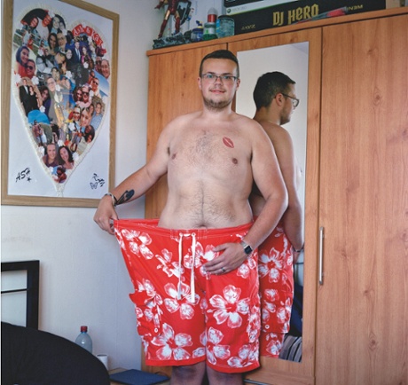 ashley stevens after gastric surgery