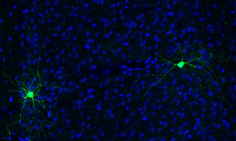 Fast-spiking interneurons in the mouse somatosensory cortex