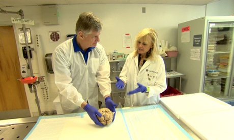 John Beattie with neuropathologist Anne McKee in Rugby and the Brain.