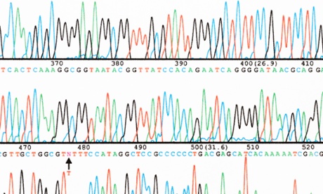 Part of a DNA base sequence read generated by an automated sequencer.