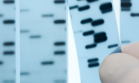 DNA sequencing. Scientist points to bands representing nucleotide bases (A,C,T,G) in an x-ray image of a gel.  Sanger 