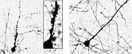 HERV alters motor neuron morphology
