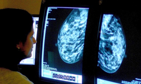 A consultant analyses a mammogram