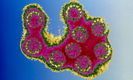  Virus on Cervical Cancer Is Caused By A Virus   The Human Papillomavirus  Hpv