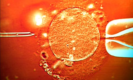 IVF treatment sperm being injected into human egg