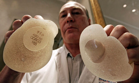 Silicone gel breast implants