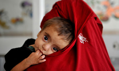 Malnutrition in Afghanistan