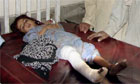 A six-year-old civilian victim of a US drone strike in Pakistan, 2009