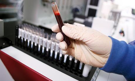 blood testing for illness