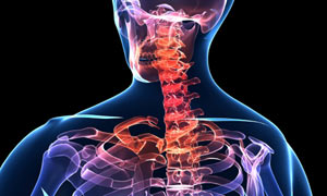 Computerised rendering of a spinal X-ray