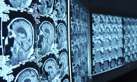 Brain CAT scans