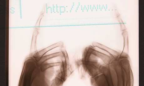 X-ray of hands pointing to web address