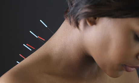 Pics Of Acupuncture