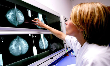 Doctors rarely discuss risks of cancer screening