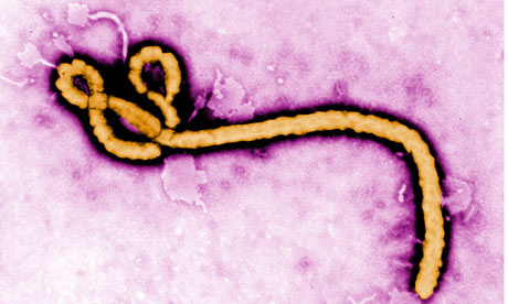 Colorized transmission electron micrograph (TEM) rof an Ebola virus virion.