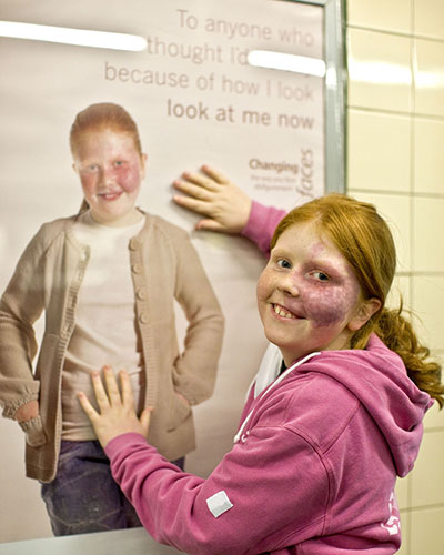 Changing Faces: MY LIFE: BILLBOARD KIDS