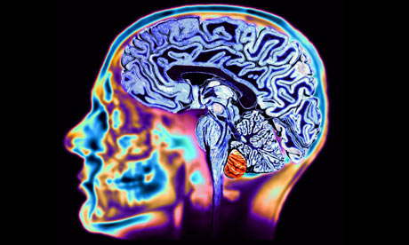 Un cerveau sain, comme on le voit sur une IRM . Photographie : photothèque Science