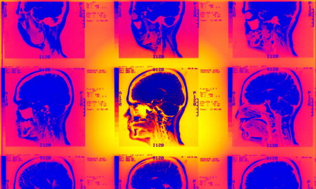 Brain scans