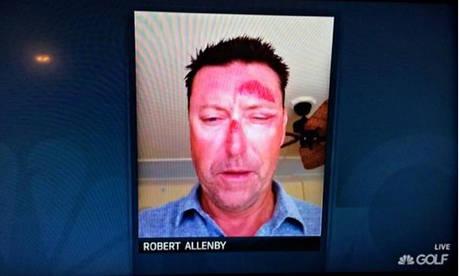 Robert Allenby