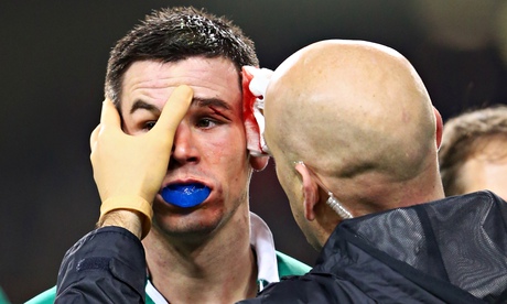 Ireland 18-11 France