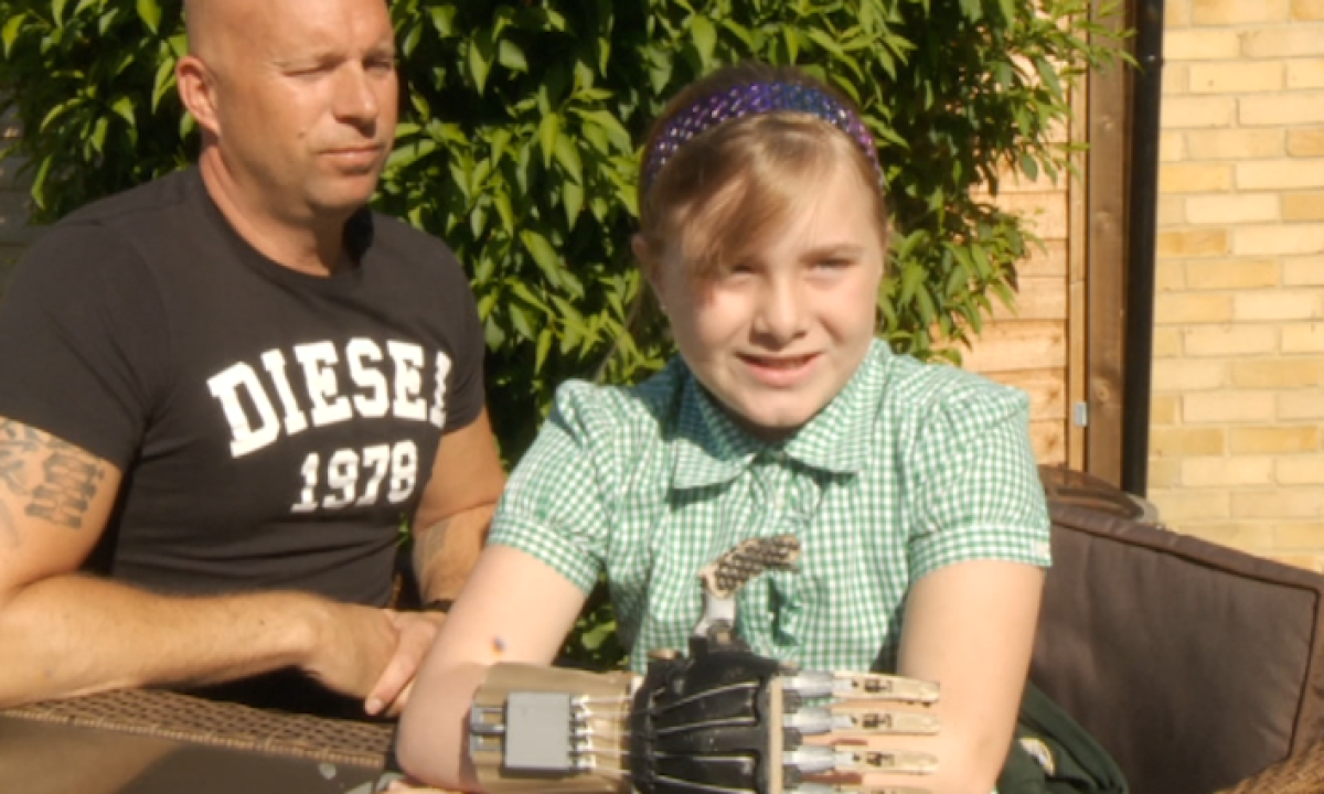 3D printer lends a hand to girl born without fingers - video