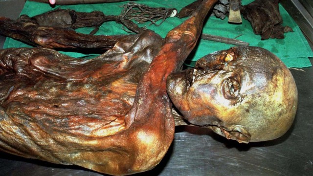 Ötzi the Iceman's 5,000-year-old stomach bug sheds light on human